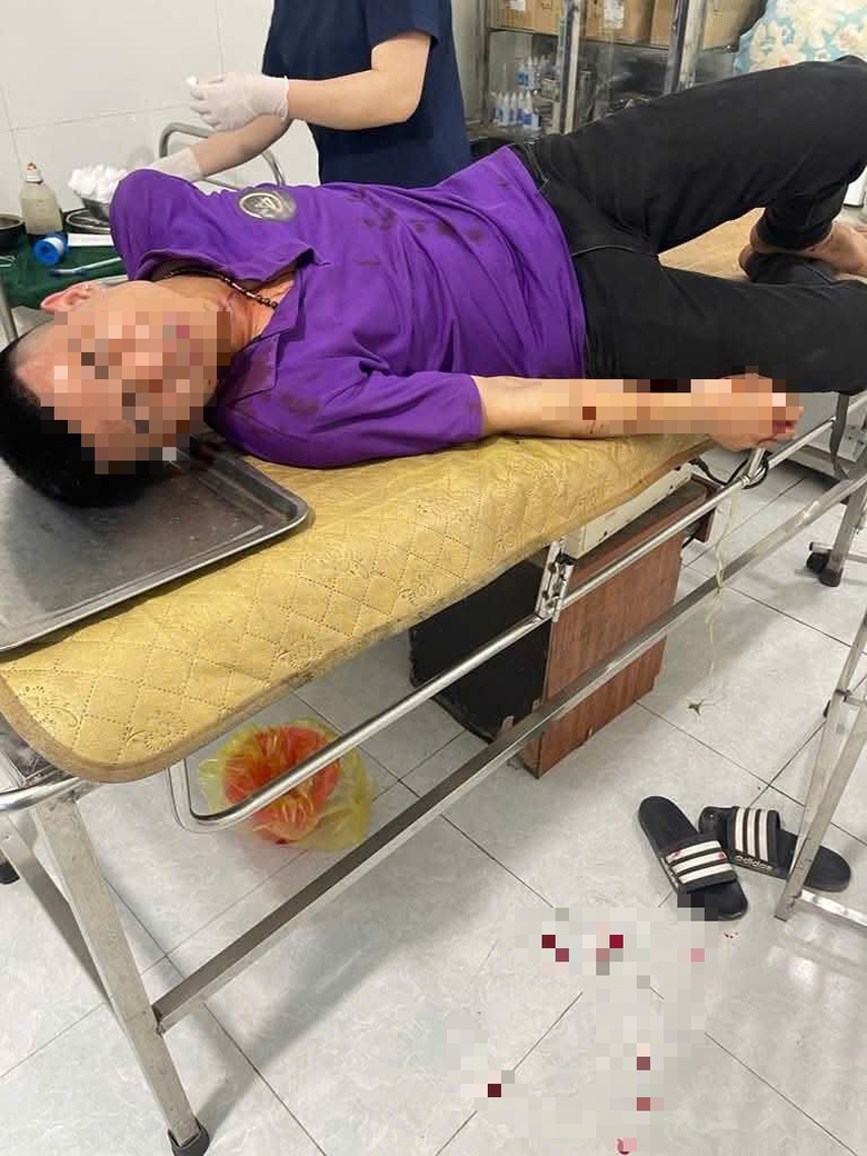 Mâu thuẫn khi tham gia giao thông, tài xế và phụ xe khách bị đánh gục trên đường- Ảnh 1. Mâu thuẫn khi tham gia giao thông, tài xế và phụ xe khách bị đánh gục trên đường- Ảnh 1.