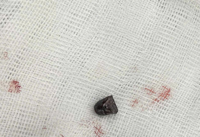 Bắt giữ kẻ dùng súng tự chế bắn trọng thương lái xe tải- Ảnh 1. Bắt giữ kẻ dùng súng tự chế bắn trọng thương lái xe tải- Ảnh 1.