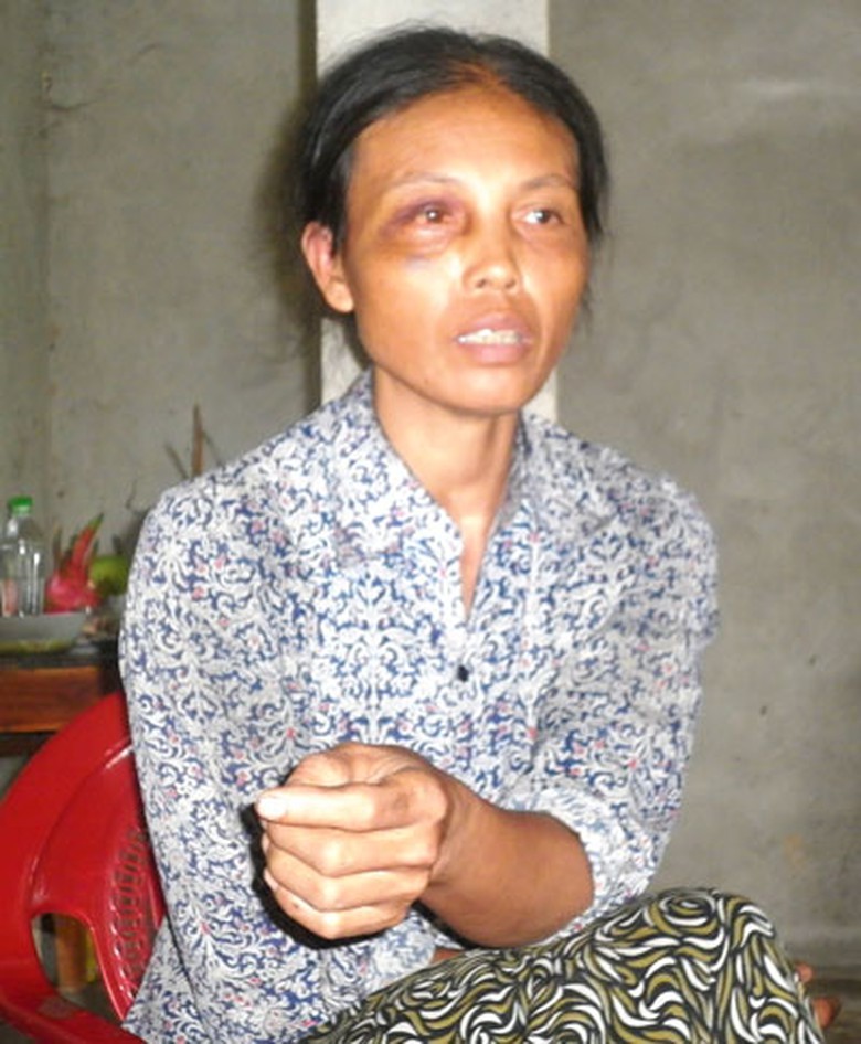 B&agrave; Lựu kể lại sự việc