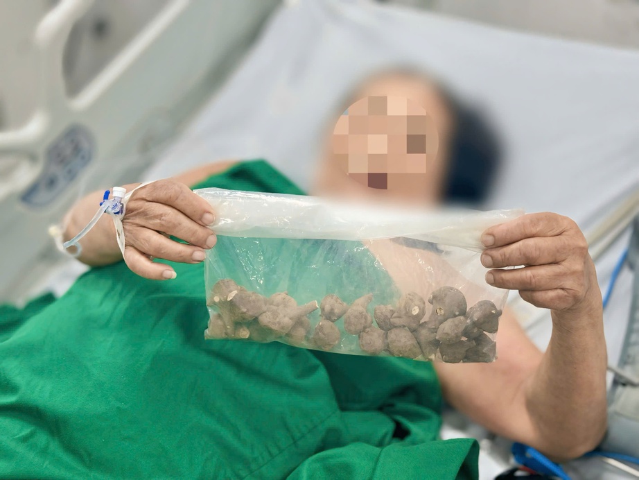 Một cụ bà nguy kịch vì dùng ấu tầu chữa khớp- Ảnh 2. Một cụ bà nguy kịch vì dùng ấu tầu chữa khớp- Ảnh 2.