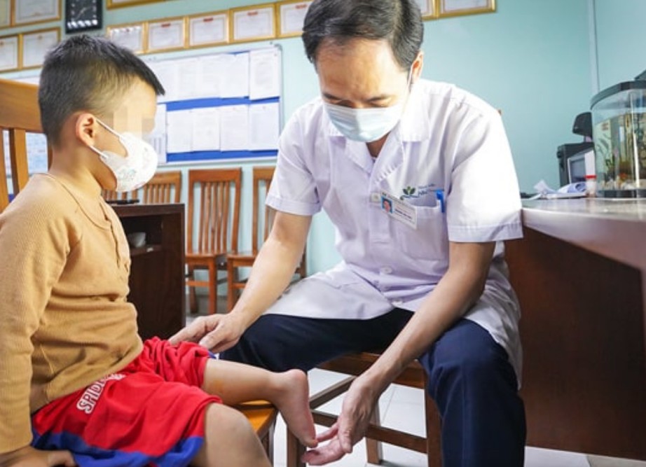 Thành công phẫu thuật xoay cẳng chân 180 độ cho bé trai 5 tuổi- Ảnh 1. Thành công phẫu thuật xoay cẳng chân 180 độ cho bé trai 5 tuổi- Ảnh 1.