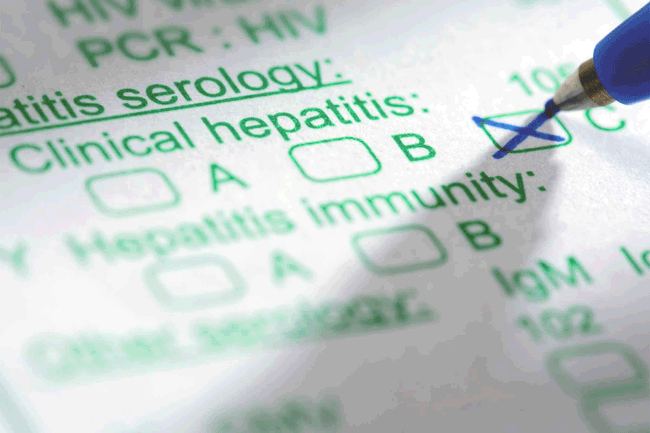 1. Tình dục không an toàn: Quan hệ tình dục không an toàn, đặc biệt là với nhiều người có thể là mối đe dọa lớn hơn đối với sức khỏe của bạn. Nguy cơ lớn nhất và khá phổ biến là bạn có thể mắc bệnh viêm gan, bệnh có khả năng gây tử vong lây qua đường tình dục.