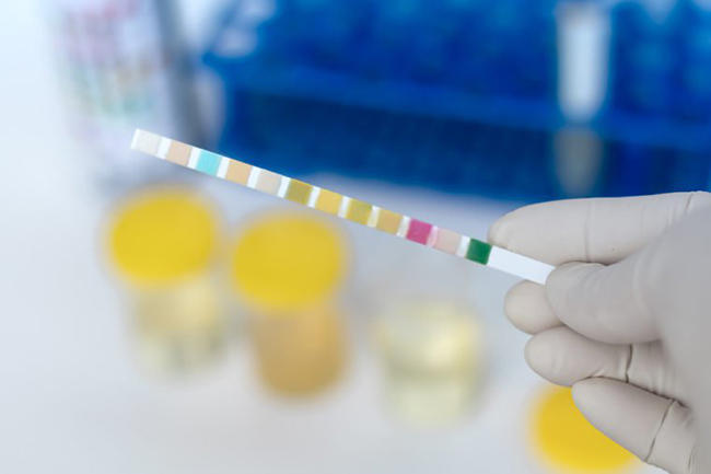 11. Đi tiểu quá nhiều có thể do nhiễm trùng đường tiết. Tuy nhiên, nếu bạn đi tiểu liên tục và luôn luôn thấy khát, bạn có thể đang mắc bệnh tiểu đường.