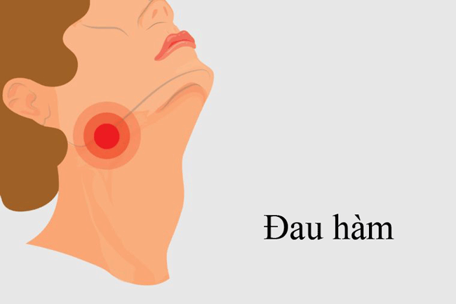 11. Đau hàm: Ung thư miệng có thể làm cho hàm của bạn bị tổn thương khi mở miệng. Hãy đến gặp bác sĩ nếu cơn đau không thuyên giảm trong vòng 2 tuần.