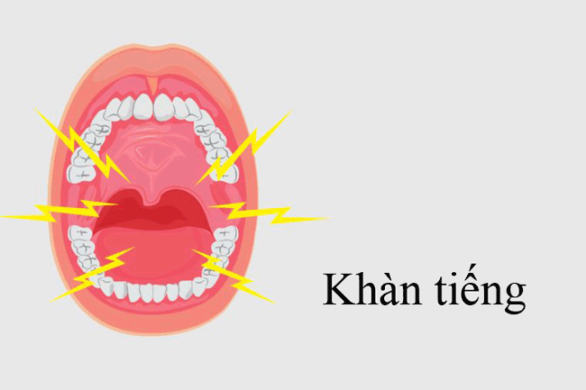 9. Khàn tiếng: Nếu bạn đột nhiên bị khàn giọng trong 2 tuần trở lên, đó có thể là dấu hiệu cho thấy ung thư miệng đang ảnh hưởng đến giọng nói của bạn.