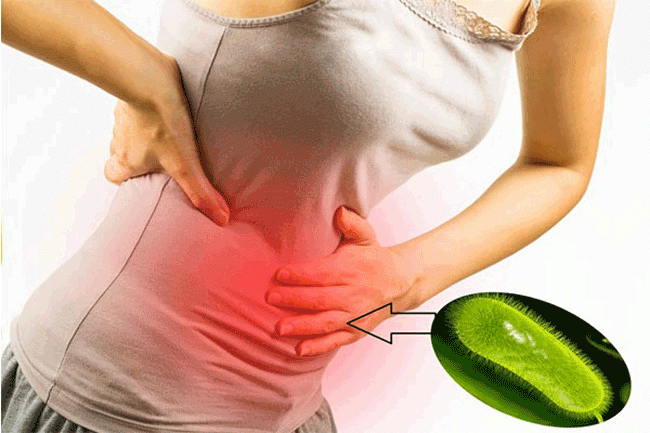 7. Thay đổi thói quen đại tiện: Những thay đổi trong thói quen đại tiện, bao gồm tiêu chảy và táo bón, thường liên quan đến các tình trạng ít nghiêm trọng hơn. Nhưng những thay đổi này cũng là một trong những dấu hiệu cảnh báo ung thư dạ dày. Nếu bạn nhận thấy sự thay đổi rõ rệt, hãy nói chuyện với bác sĩ để được chẩn đoán sớm.