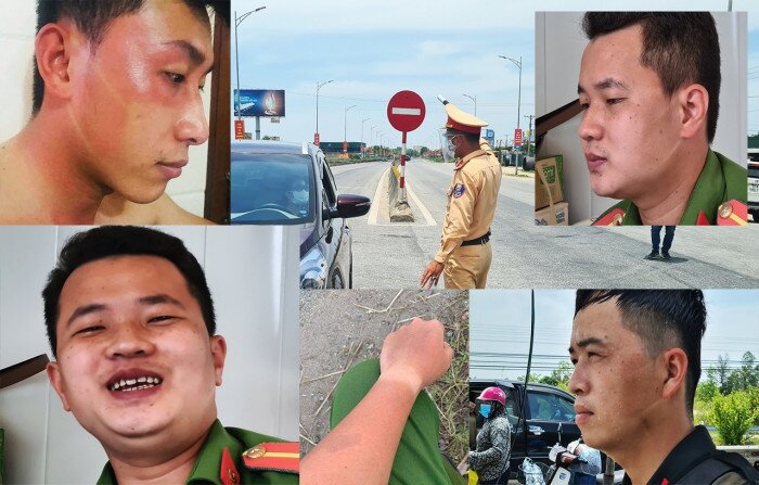 Hình ảnh những người chiến sĩ 2 màu da vì cháy nắng nơi tuyến đầu khiến ai cũng cảm thấy thắt lòng