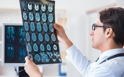 Cặp vợ chồng cùng nhập viện vì nhồi máu não do loại thực phẩm vạn người mê