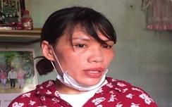 Bắt hai “nữ quái” gây w88 hàng chục vụ trộm cắp tài sản