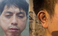 Vụ nhân viên xin nghỉ việc bị đánh biến dạng mặt: Chủ quán khai nhận gì?