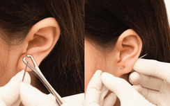 Cẩn trọng biến chứng khi xỏ khuyên tai