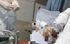 Truy bắt đối tượng ném bom xăng khiến một cháu bé bỏng nặng ở Bình Thuận