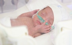 Hành trình hồi sinh bé gái sinh non chỉ nặng 550 gram