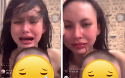 Nữ người mẫu Việt ôm con livestream khóc lóc trong tình trạng chảy máu miệng