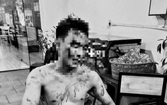 Hải Dương: Nam thanh niên bị đánh nhập viện khi đang ngồi trong phòng trà 
