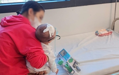 Cảnh báo biến chứng khi trẻ mắc cúm A