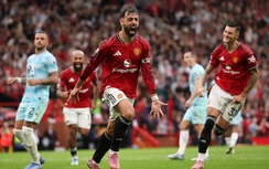 Bruno Fernandes ghi bàn quyết định, MU hạ Burnley kịch tính