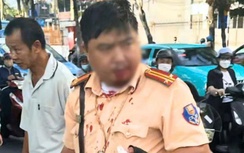 Tạm giữ hình sự nam thanh niên người Nga tấn công trung tá CSGT