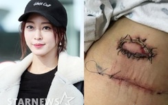Phẫu thuật "lỗi" cho nữ diễn viên Hàn, bệnh viện lên tiếng xin lỗi
