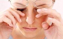Khoảng 6 triệu người mắc bệnh khô mắt