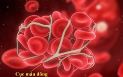 30 nghìn người Việt mang gen bệnh rối loạn đông máu