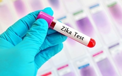 TP HCM phát hiện 17 ca nhiễm virus Zika