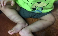 Vụ bé trai 1 tuổi bị bạo hành: Quyết định khởi tố vụ án