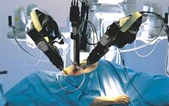 Hơn 100 bệnh nhân sẽ được phẫu thuật nội soi bằng robot