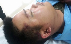 Vụ tài xế xe buýt ở Hà Tĩnh bị đánh có "chìm xuồng"(!?)