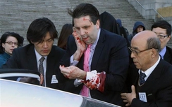 Đại sứ Mỹ tại Hàn Quốc bị "giết hụt" bằng dao lam