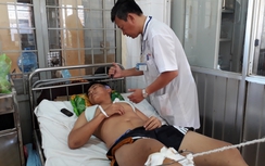 Cảnh sát cơ động Đắk Lắk bị "quái xế" đâm trọng thương