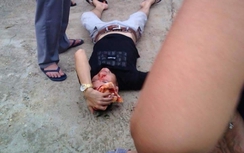 Thông tin chính thức vụ CSGT Tuyên Quang bắn vào đầu nam thanh niên