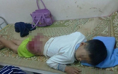 Phẫn nộ bố đánh con tứa máu, bầm tím người ở Thái Nguyên