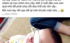 Sự thật hình ảnh cháu bé bị bố chém trọng thương ở Tuyên Quang