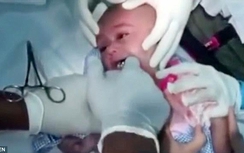 Video: Rợn gáy cảnh lấy đồng hồ ra khỏi cổ họng em bé