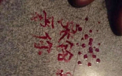 Hoảng hồn cô gái cắt tay viết "huyết thư" cho bạn trai