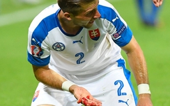 Ấn tượng EURO 2016: Cầu thủ Slovakia đổ máu trên sân