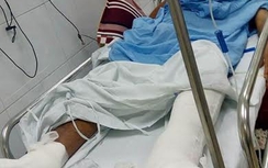 Bệnh viện Việt Đức mổ nhầm chân bệnh nhân: Bộ trưởng Tiến nói gì?