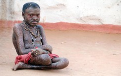 Ấn Độ: Người đàn ông cứ 10 ngày lại tự lột da một lần