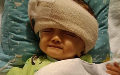 Cộng đồng mạng hỗ trợ, bé Hoài Thương đã được phẫu thuật