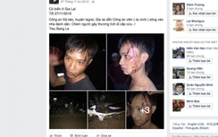 Gia Lai: Đang điều tra vụ công an xã bị tố chém trai làng