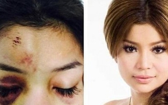 Bắt đại gia Campuchia đánh đập dã man nữ diễn viên xinh đẹp