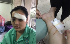 Khởi tố vụ cô gái bị hành hung và cắt tai ở Sài Gòn