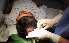 Bác sĩ BV Việt Yên bị tấn công bằng máy đo huyết áp