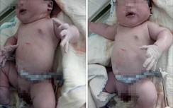 Trẻ sơ sinh 7,1kg vào kỷ lục Việt Nam