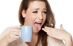 6 cách giúp giảm cảm giác bỏng rát lưỡi khi ăn đồ quá nóng