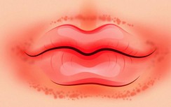Chỉ cần nhìn 8 dấu hiệu này của môi, bạn có thể tự "bắt bệnh" cực chính xác