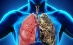 Người có phổi xấu, 3 vị trí này trên cơ thể sẽ chuyển sang màu đen