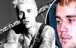 "Hoàng tử nhạc Pop" Justin Bieber mắc căn bệnh lạ, khó chẩn đoán nhưng hậu quả cực nghiêm trọng