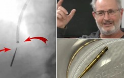 Người đàn ông suýt cắt bỏ 1 phần phổi vì hít phải mũi khoan khi làm răng